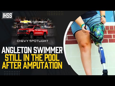 Anna Eberspacher Has Overcome Obstacles to Still Compete in the Pool