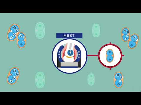 Actiune MBST® - tratament osteoartrita si osteoporoza prin stimularea regenerarii tesuturilor