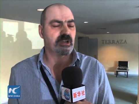 Man with artificial arm tells how technology changes his life