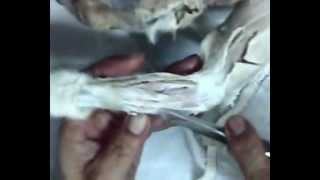 preview picture of video 'Cat Muscular System Region 3 Dissection.mp4'