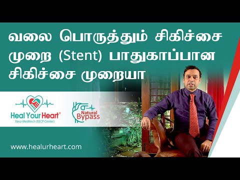 வலை பொருத்தும் சிகிச்சை முறை(STENT) பாதுகாப்பான சிகிச்சை முறையா ?
