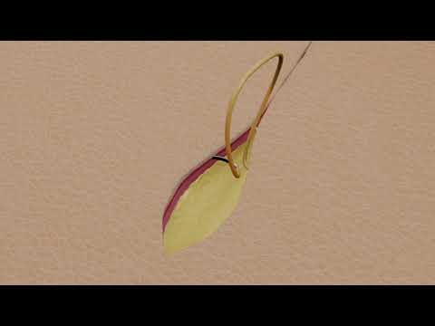 Suture Techniques - Subcuticular Running Suture