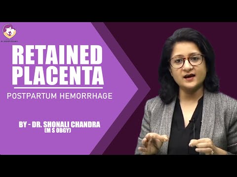 Retained Placenta : Clinical Scenario : Causes & Management : Dr. Shonali Chandra #NEET PG #AIIMS PG