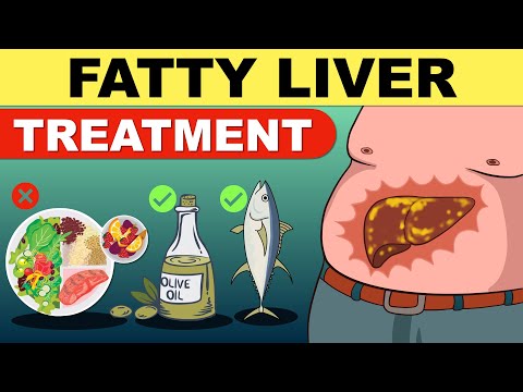 , title : 'Fatty Liver Treatment | Fatty Liver Diet | Liver Detox | Fatty Liver | Fatty Liver Symptoms'