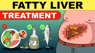 Fatty Liver Treatment | Fatty Liver Diet | Liver Detox | Fatty Liver | Fatty Liver Symptoms