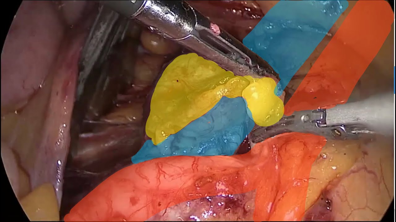 Albert Zevallos Cardenas-20