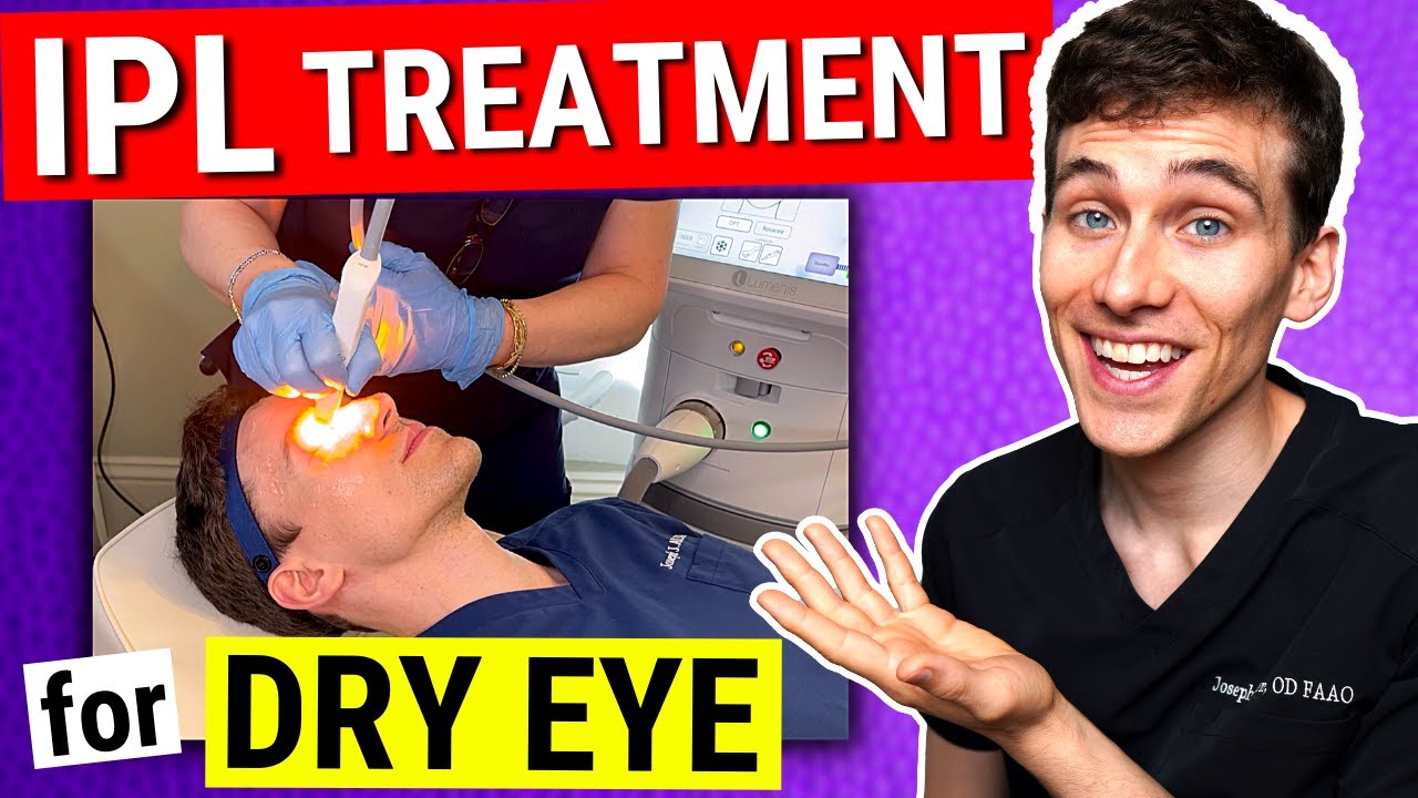 OptiLight IPL for Dry Eye procedure video