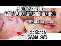 Cosmetics Or Skin Care That Are Not Allowed Or Are Not Safe For Breastfeeding Mothers Can Have A