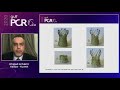 Transcatheter Valve In Valve Procedure Making Tomorrow Today GulfPCR GIM 2020