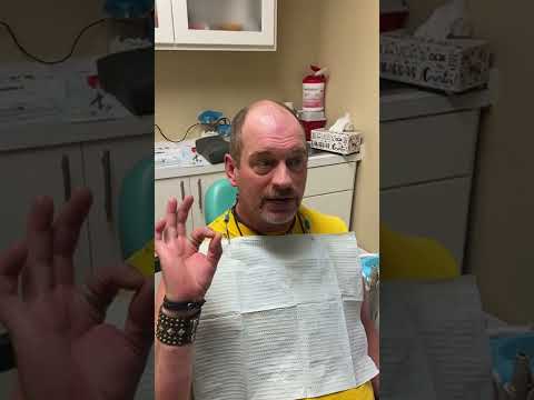 Patient randy second visit for all on four on zirconia prettau