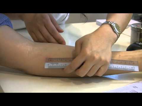 Allergy test, skin  test,  skin prick test, allergy test hong kong - CAAC