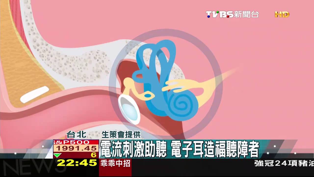 【科學不一樣】電流刺激助聽 電子耳造福聽障者