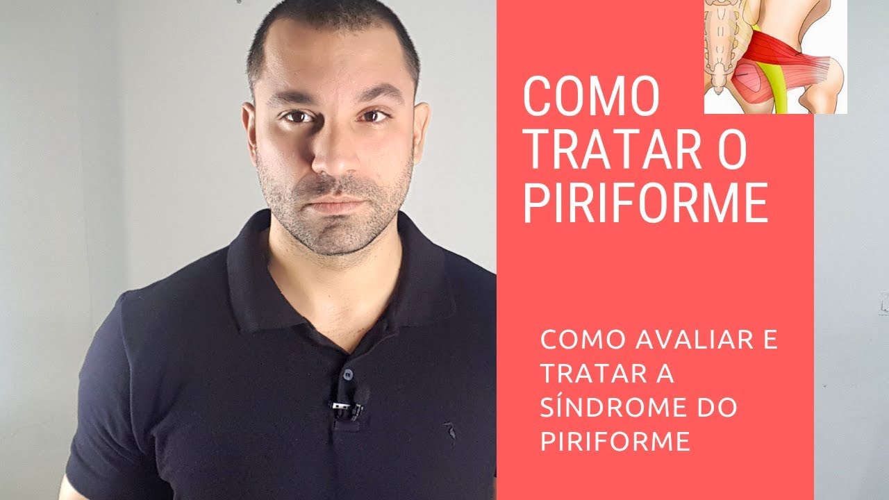 Como tratar a síndrome do piriforme