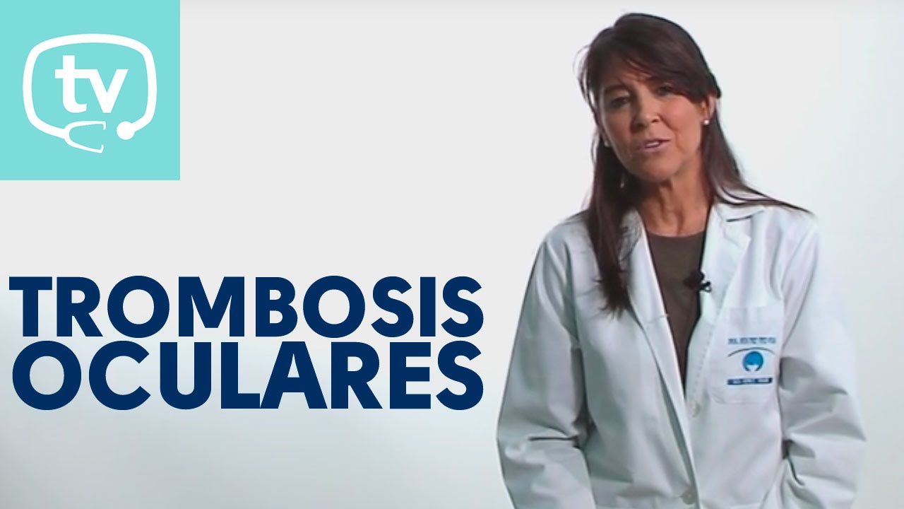 Watch Trombosis ocular ¡todo lo que debes saber! Now Trombosis ocular ¡todo lo que debes saber!