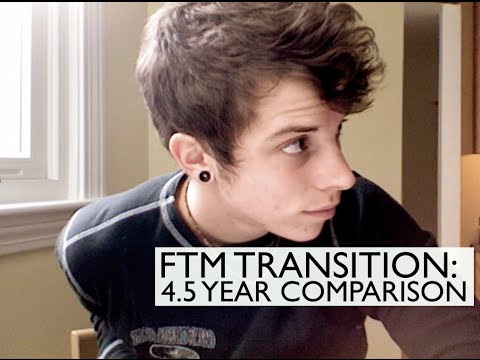 FTM Transition: 4.5 years on Testosterone comparison!