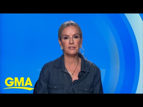 Tips to prevent varicose veins