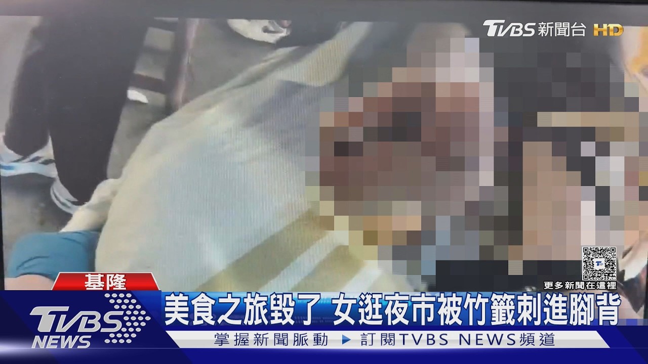 影音／頭皮發麻！女子逛基隆夜市踩中竹籤　整支插進右腳痛到走不動