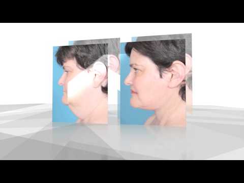 MS DMMD Testimonial Nu-Living