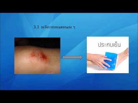 วิธีการปลุกระดมคำผู้หญิง ความอ่อนแอทิงเจอร์กระเทียม