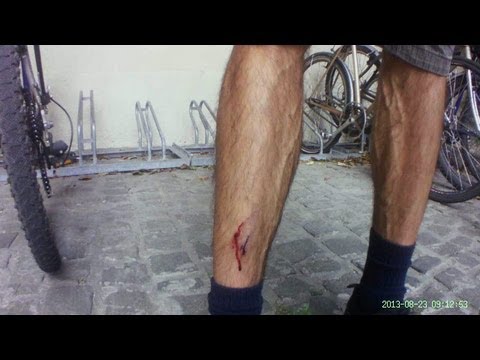 Pedal hits my shin - Pedál telibe a sípcsontomat