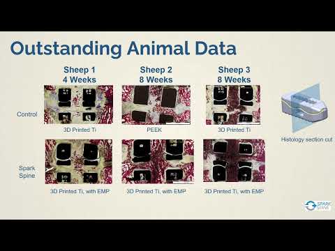 Luke Diehl, Spark Spine - Electrical biomaterial for orthopedic implant healing | LSI USA '26