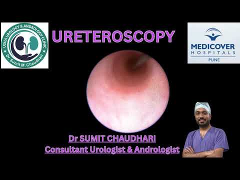 Ureteroscopy - Endoscopic examination of ureter | Dr. Sumit Chaudhari 