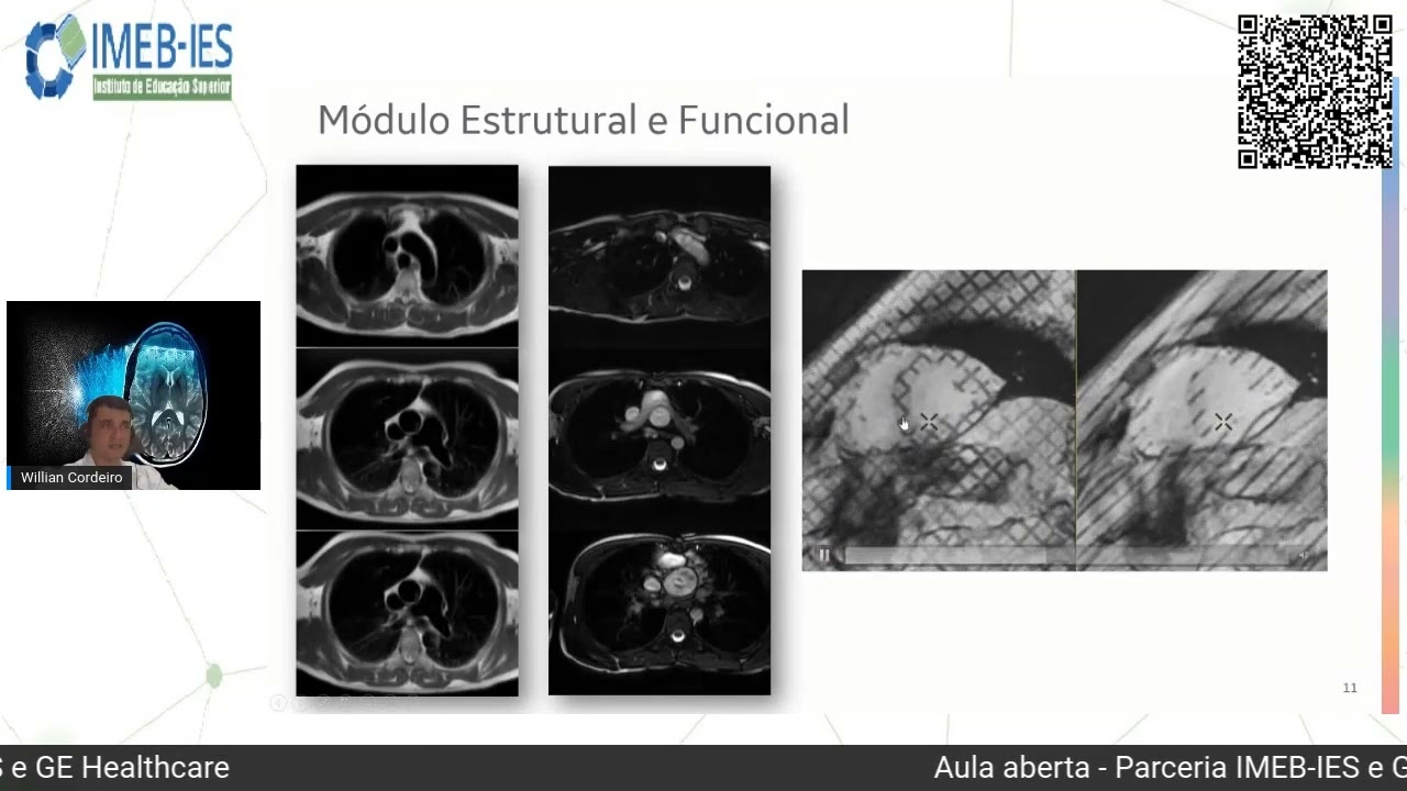 Protocolos de Ressonância Magnética do Coração | GE HealthCare Brasil