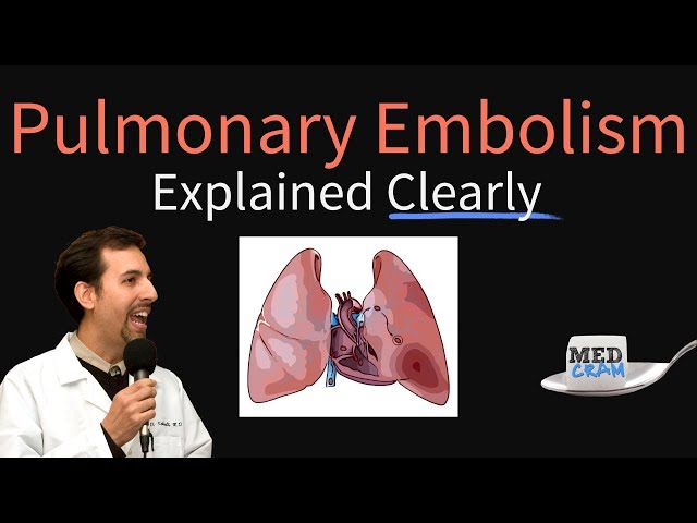 Videouttalande av pulmonary embolisms Engelska