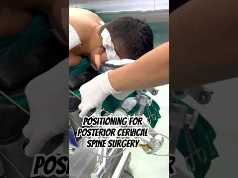Head positioning for cervical spine surgery 😲