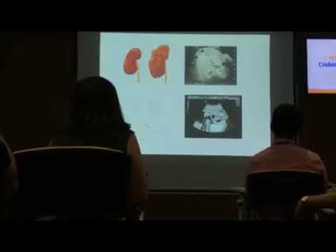 Prenatal Diagnosis of CAKUT and genetic aspect | Steven Shaw