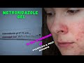 Metronidazole gel for Pimples and Red bumps||Treating Rosacea and Inflammatory Lesions