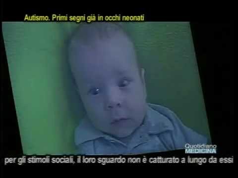 Camminare prolungato con osteoartrosi del ginocchio Benda fionda sulla caviglia