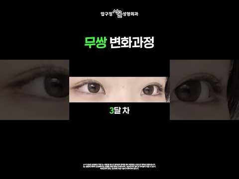 �䳢��🐰 û�� �ξƿ����� �ڿ����� �ּ� �ı�