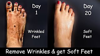 Remove Feet Wrinkles | Get Rid of Cracked Heels & Baby Soft Feet | Collagen Stimulating cream oil