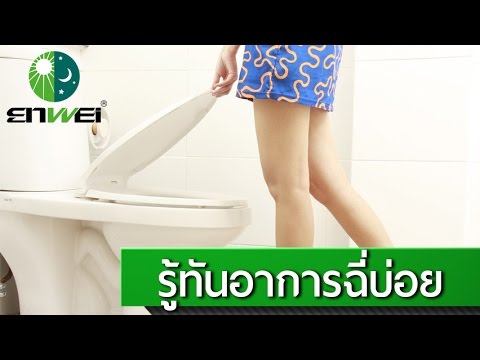 กระต่ายชายแรง เป็นแบบเลื่อนค้อนพรู prinimat