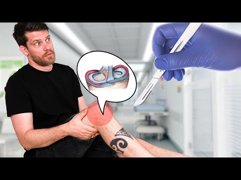 Can a torn meniscus heal WITHOUT surgery?