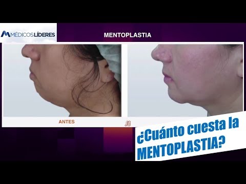download lagu mp3 mp4 Operacion De Menton Precio Peru, download lagu Operacion De Menton Precio Peru gratis, unduh video klip Operacion De Menton Precio Peru