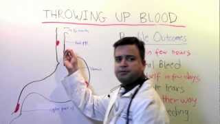Throwing up blood: A video for patients
