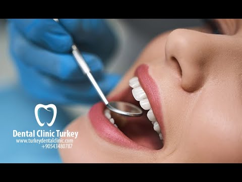 VIP Dental Clinic Turkey - Always Smile, Always Stay Beautiful