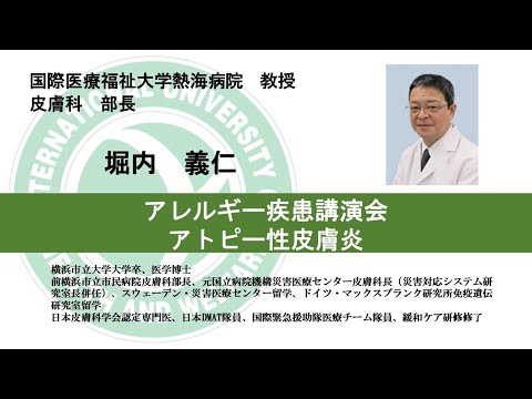 国際医療福祉大学熱海病院　オンライン健康講座「アトピー性皮膚炎」堀内義仁