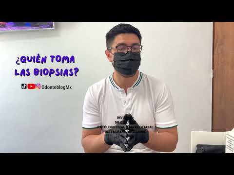 ¿Quién debe tomar las BIOPSIAS?