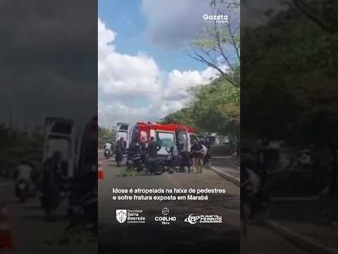 Idosa é atropelada na faixa de pedestres e sofre fratura exposta em Marabá