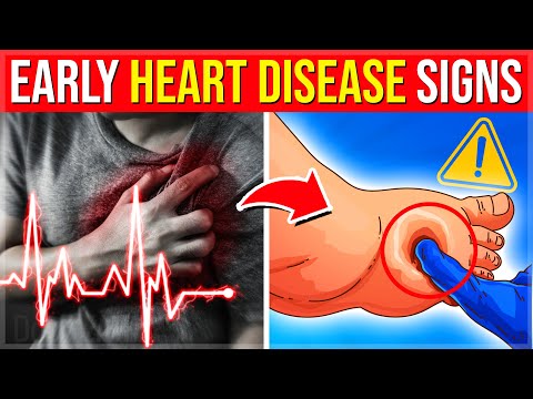 12 EARLY Heart Disease Signs Your Body Is Begging For You To Notice FAST