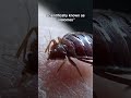 Can Bed Bugs Bite Without You Knowing?