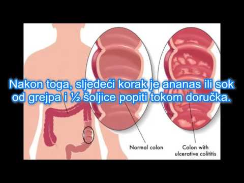 klistir intestinalni hipertenzija eliminirati uzroka hipertenzije
