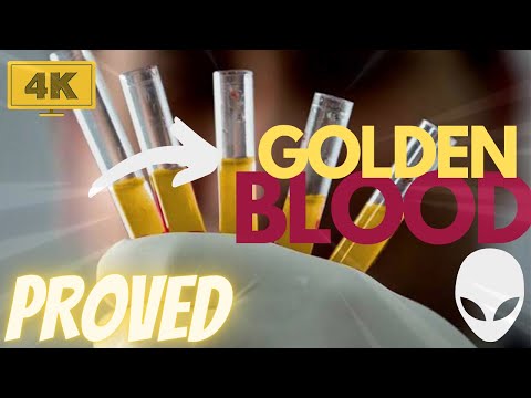 RAREST BLOOD TYPE - GOLDEN BLOOD | UNKNOWN FACT