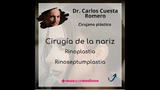 Rinoplastia - Rinoseptumplastia - Doctor Carlos Cuesta Romero