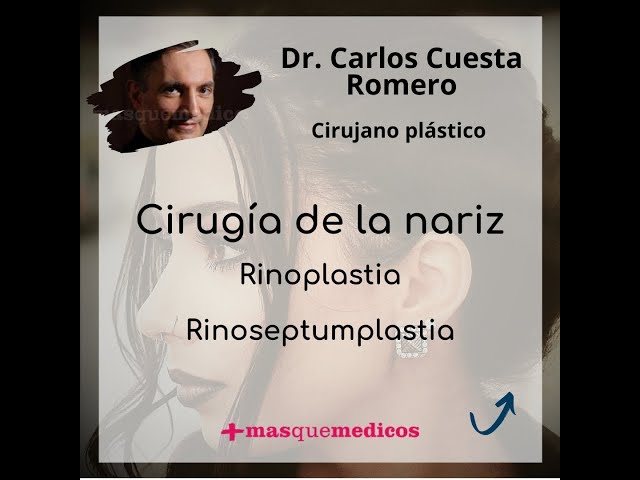 Rinoplastia - Rinoseptumplastia - Doctor Carlos Cuesta Romero