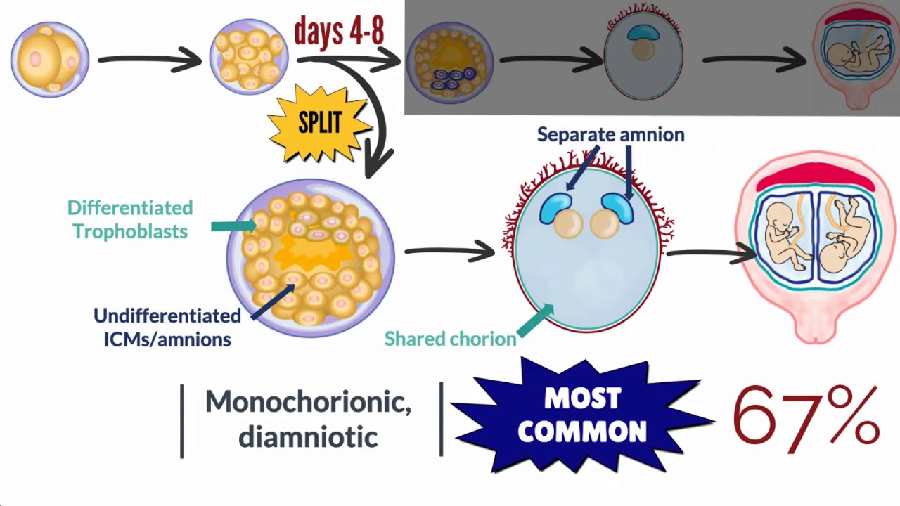 APGO Basic Sciences - Topic 21: Multiple Gestation Pregnancies