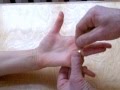 Как снять кольцо с пальца 
